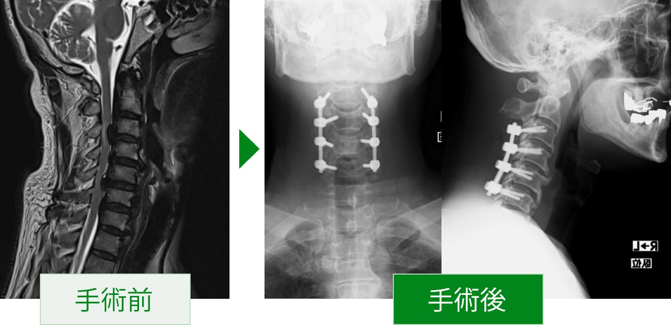 埼玉脊椎脊髄病センター｜診療科ご案内｜東埼玉総合病院